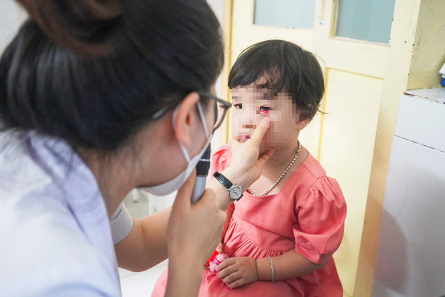 Bệnh đau mắt đỏ đang có xu hướng gia tăng tại một số tỉnh, thành phố như Hà Nội, Đà Nẵng, TP Hồ Chí Minh...