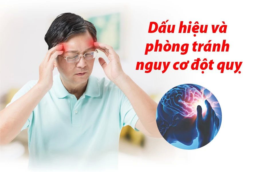 Dấu hiệu cho thấy bạn có nguy cơ đột quỵ vì nhiệt