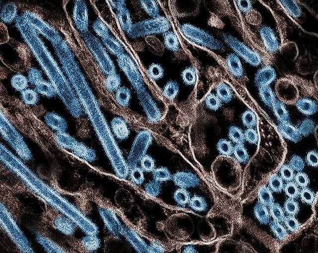 Virus cúm gia cầm H5N1 (xanh) được nuôi cấy trong phòng thí nghiệm ở Mỹ