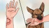 BỆNH DẠI RẤT NGUY HIỂM – CHỈ CÓ TIÊM NGỪA MỚI KHÔNG TỬ VONG