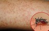 Hứa hẹn phát triển vaccine ngừa sốt xuất huyết từ nước bọt của muỗi