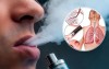 Tỷ lệ sử dụng thuốc lá điện tử tăng 18 lần sau 5 năm, nhiều hệ luỵ khôn lường cho sức khoẻ