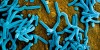 Hình ảnh hiển vi điện tử quét màu của những hạt virus Marburg ( màu xanh lam ) dính vào mặt phẳng của những tế bào VERO E6 bị nhiễm bệnh ( màu vàng ).