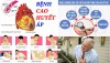Các biện pháp phòng bệnh Tăng huyết áp cụ thể