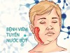Khuyến cáo các biện pháp phòng bệnh quai bị