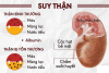 Khi mắc đái tháo đường một thời gian sẽ dẫn đến các tổn thương thận.