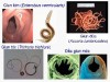 Bệnh do Ký sinh trùng: nguyên nhân và cách phòng tránh