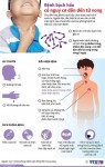 BỆNH BẠCH HẦU VÌ SAO CÓ THỂ GÂY TỬ VONG, CÁCH PHÁT HIỆN SỚM CẦN BIẾT