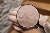 Đậu mùa khỉ là một bệnh truyền nhiễm do virus đậu mùa khỉ gây ra.