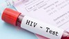 Xét nghiệm HIV là bước quan trọng trong phát hiện sớm, điều trị kịp thời và phòng ngừa lây nhiễm HIV.
