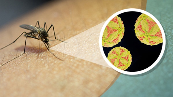 Viêm não Nhật bản là bệnh truyền nhiễm cấp tính, gây nhiễm trùng nghiêm trọng hệ thần kinh trung ương ở trẻ em và người lớn.