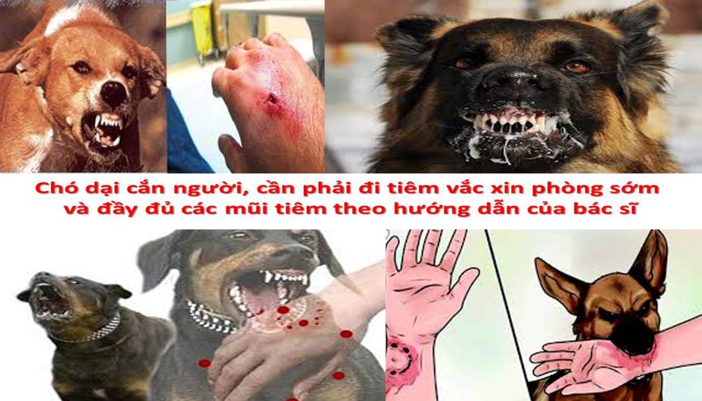 BỆNH DẠI NHỮNG ĐIỀU CẦN LƯU Ý