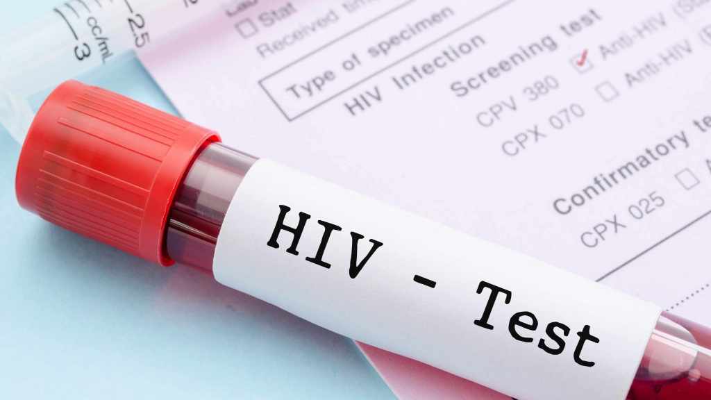 Xét nghiệm HIV là bước quan trọng trong phát hiện sớm, điều trị kịp thời và phòng ngừa lây nhiễm HIV.